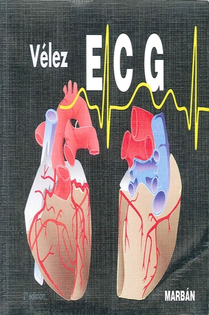 ECG: pautas de electrocardiograma